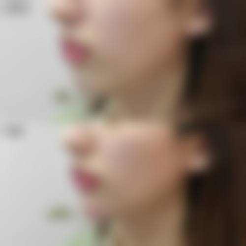 四、长春领美整形医院特色项目