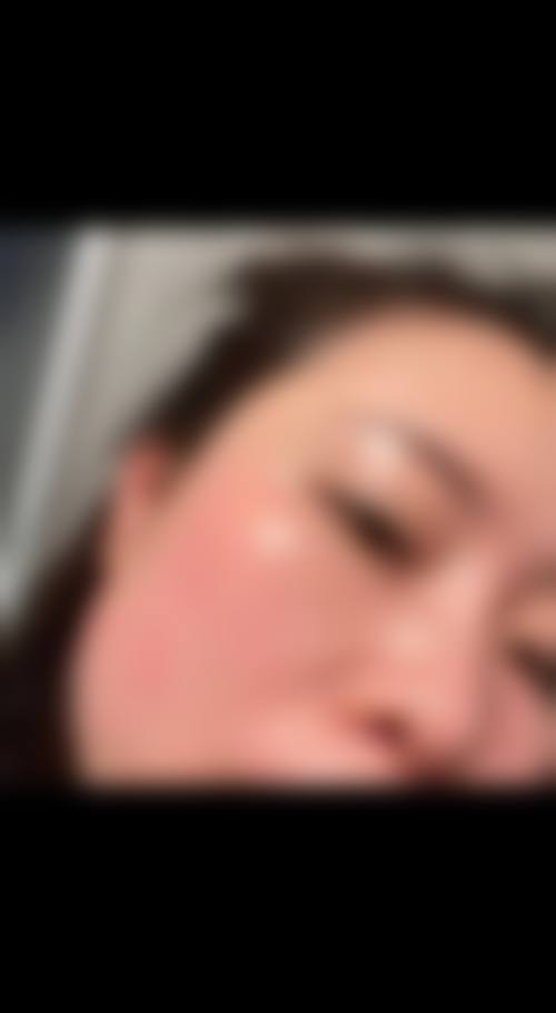 九、淮北天使整形医院真实的患者评价