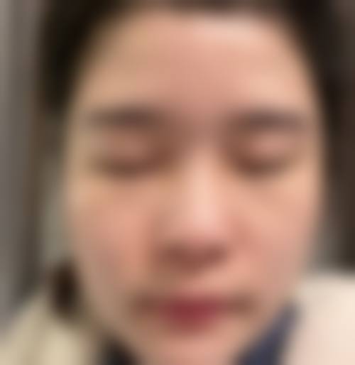 九、徐州华美医疗整形医院真实的患者评价