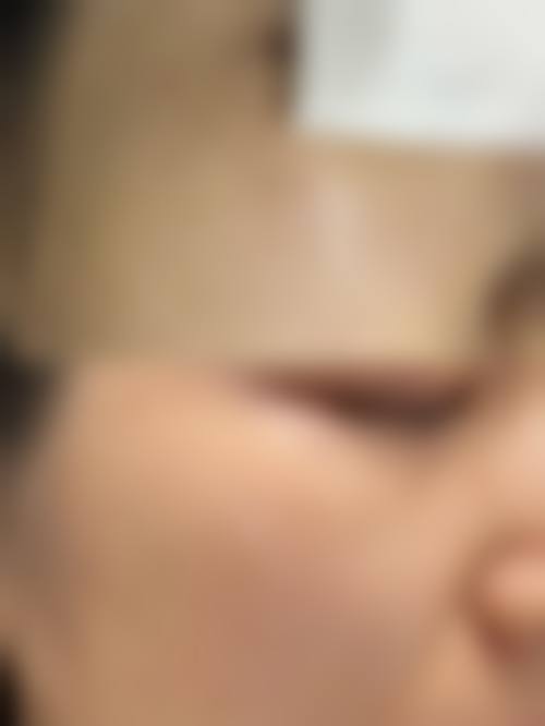 六、郑州安琪儿医疗美容门诊价格表