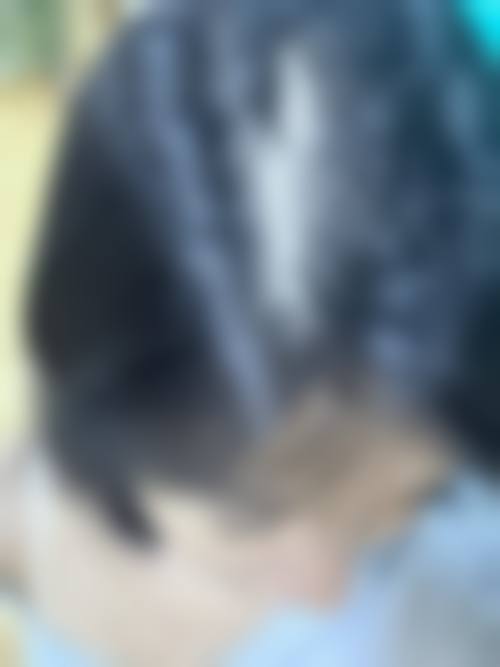 四、广西诺澜登医疗美容诊所特色项目