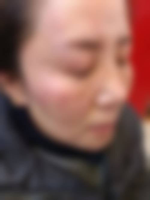 二、北海美秀中禾整形美容医院怎么样？