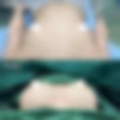 六、郑州张伶伶医学整形研究所价格表