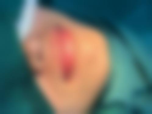 九、威海董立鹏整形医疗美容诊所真实的患者评价