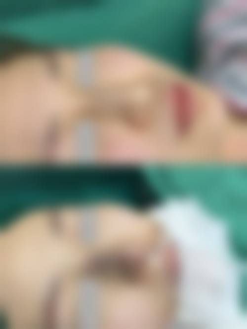 八、徐州华美医疗整形医院预约方式