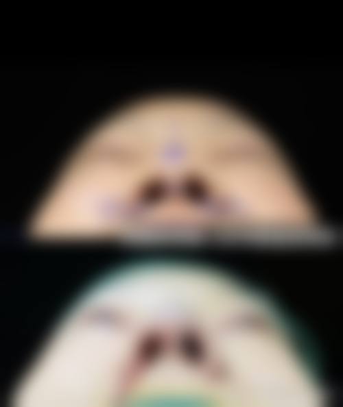 九、广西诺澜登医疗美容诊所真实的患者评价