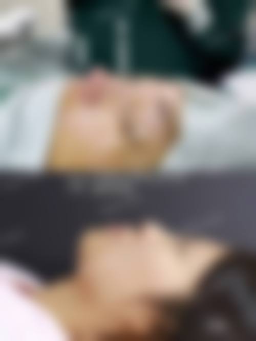 四、北京亚馨美莱坞整形医院特色项目