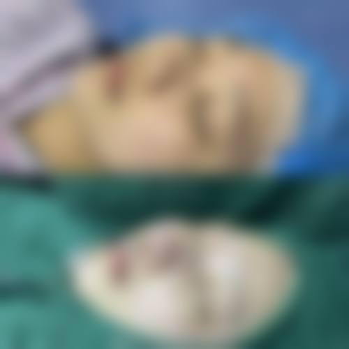 三、北京亚馨美莱坞整形医院诊疗项目有哪些？