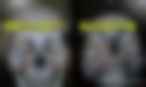 六、北京亚馨美莱坞整形医院价格表