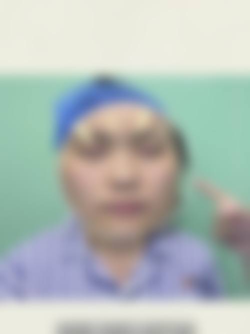 二、深圳美雅童颜医疗美容医院怎么样？