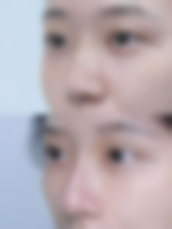 吃什么帮助疤痕恢复最快？优质蛋白、维C、维A等食物是关键！ 