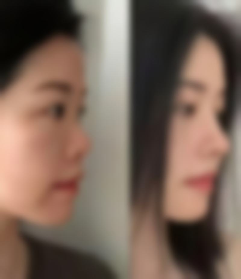 二、眼霜的作用和成分