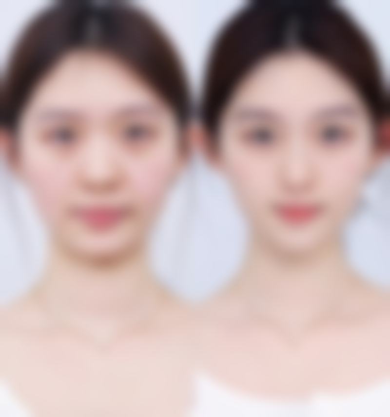 二、济宁医佳艺医疗美容诊所怎么样？