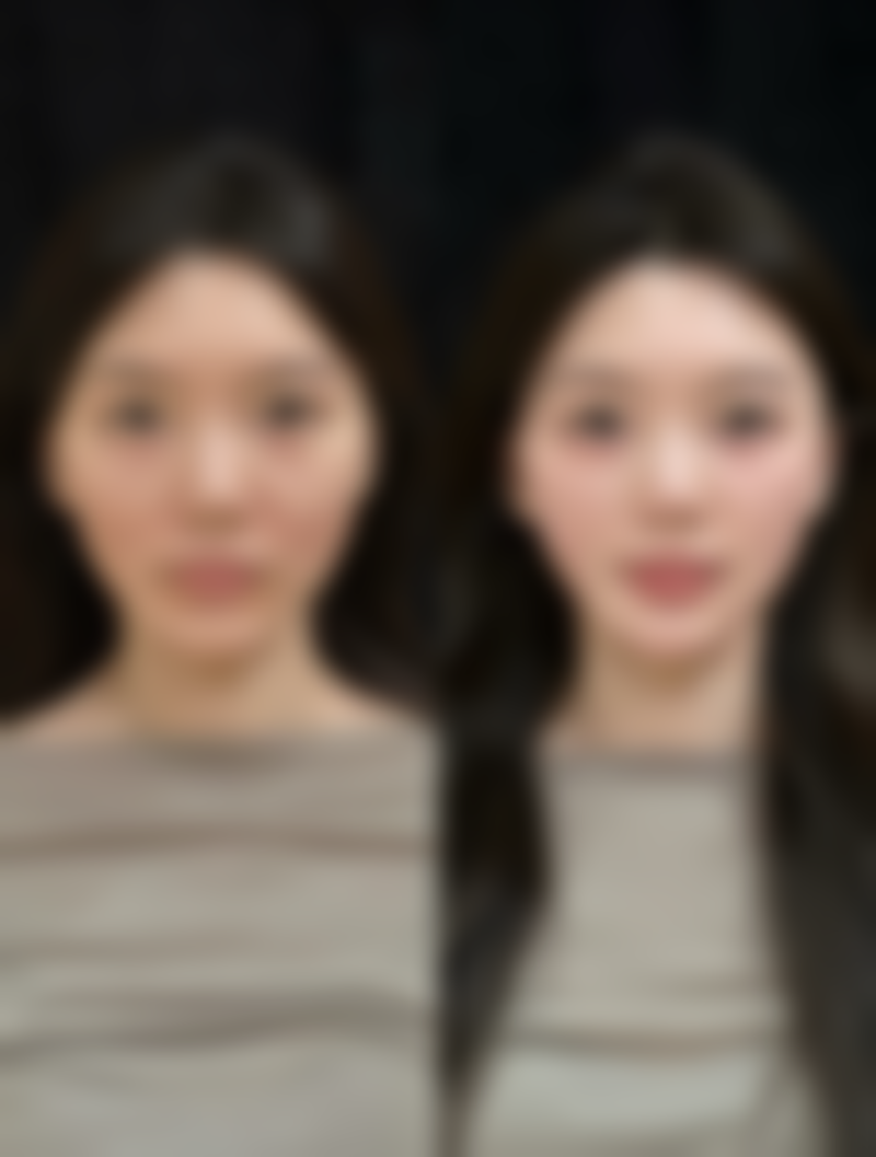 八、合肥韩宫国内外整形真实的患者评价