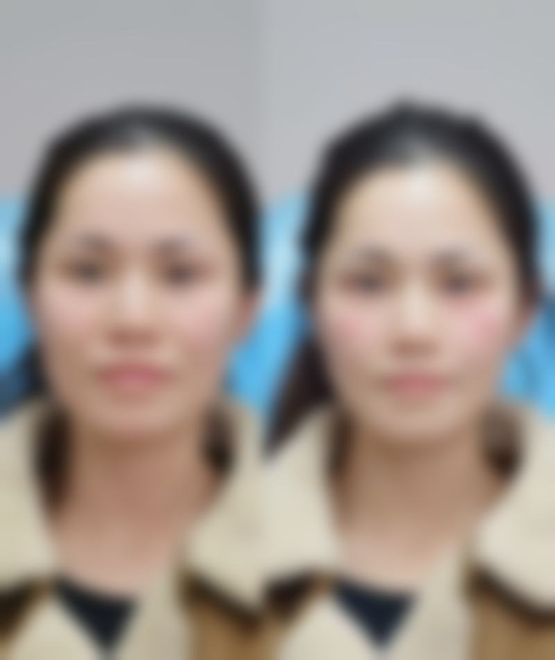 四、威海董立鹏整形医疗美容诊所特色项目