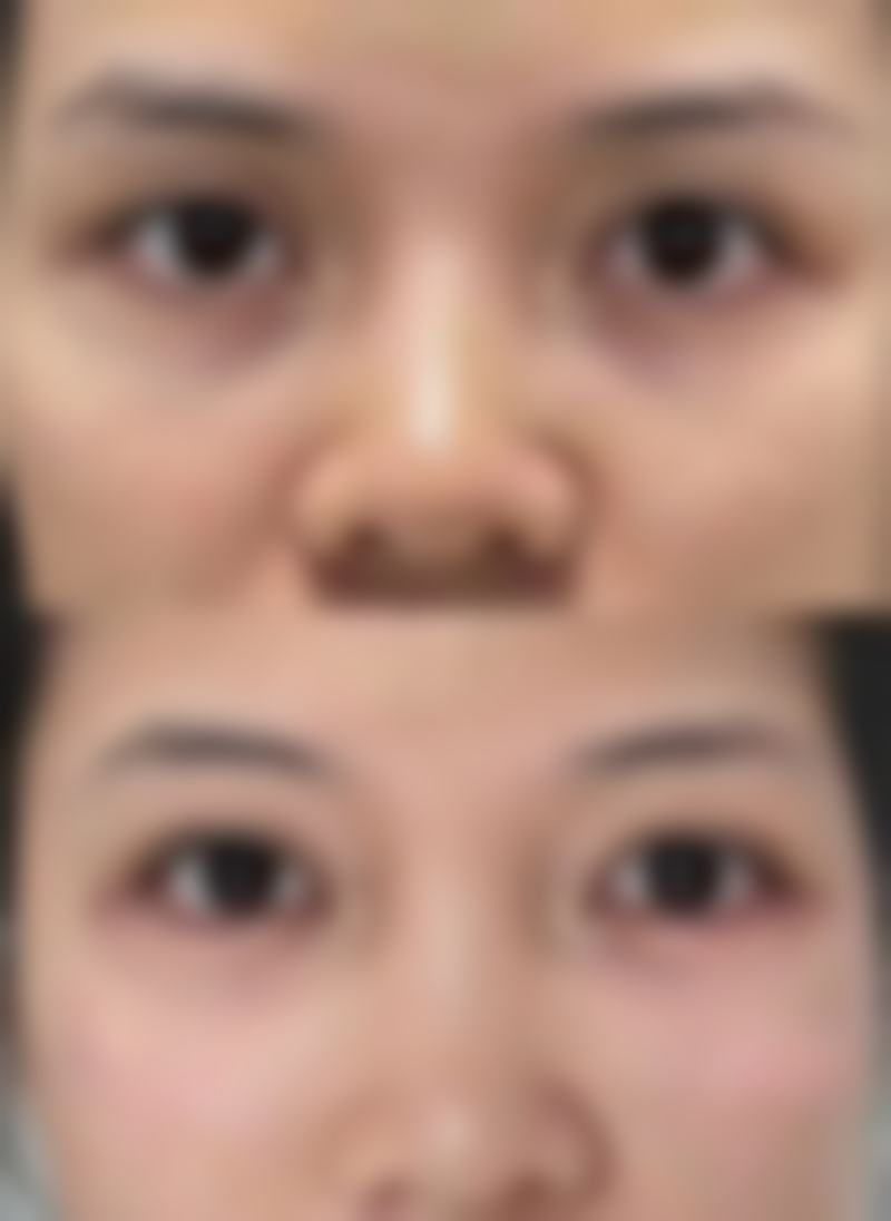 六、兴化艾尚美医疗美容医院价格表