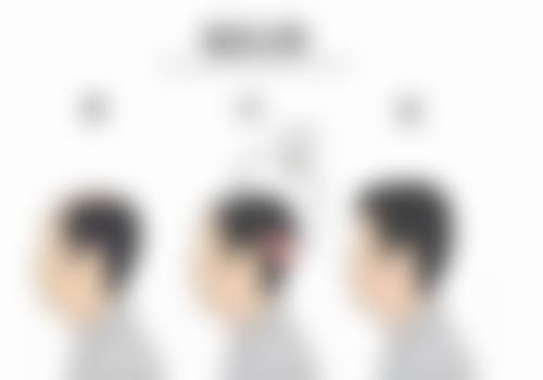 三、AGA皮肤科浜松诊疗项目有哪些？