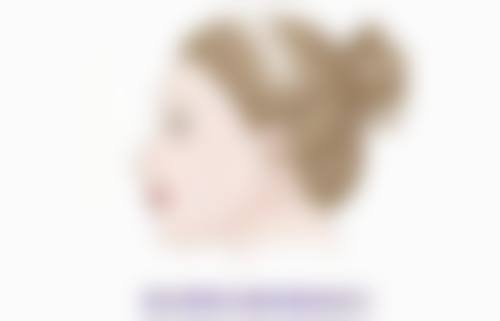 三、脸上缝合疤痕的修复阶段