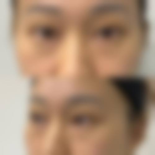 五、北京漾之颜整形医院价格表