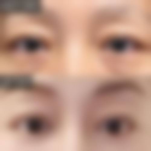 二、GLOW Clinic 大阪心斎桥怎么样？