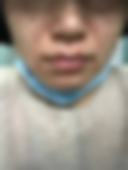 东北国内外医院医疗美容科价格表