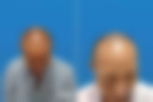 八、AGA皮肤科浜松真实的患者评价