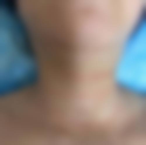 六、GLOW Clinic 大阪心斎桥价格表