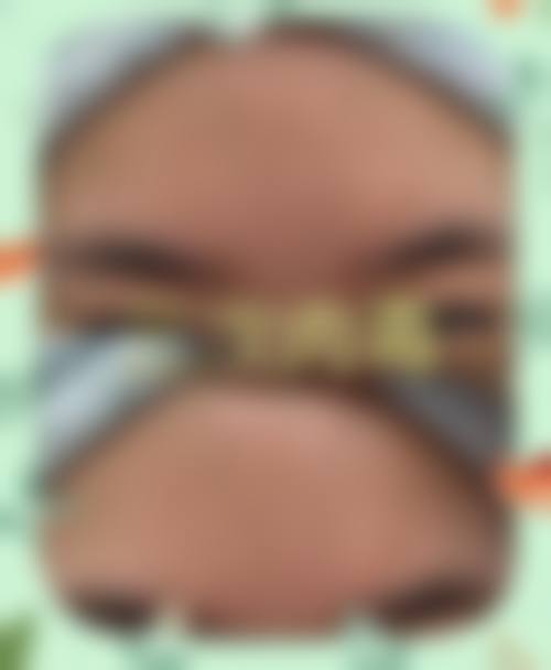 四、宁德郑荣福整形医院特色项目