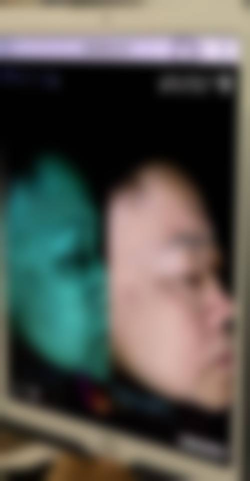 九、广州科佳医疗美容诊所真实的患者评价