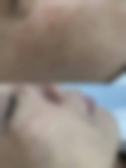 八、济南徐晶整形美容机构真实的患者评价