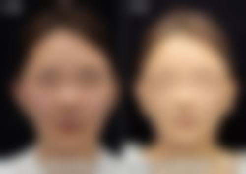 九、中山尼姬医疗美容门诊部真实的患者评价