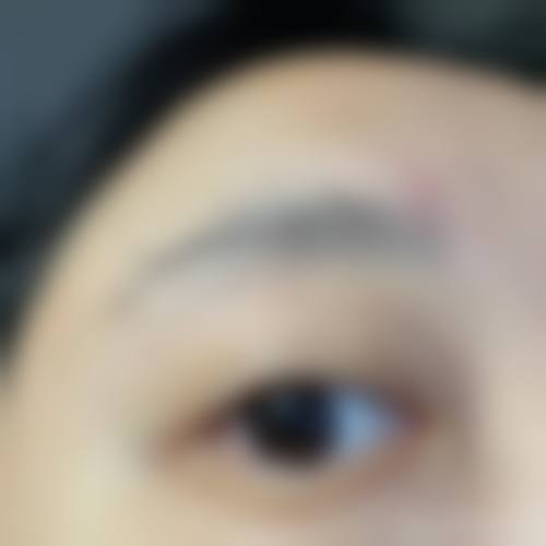 内蒙古自治区人民医院(整形美容科)怎么样？