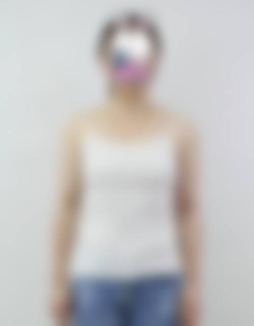 四、济南徐晶整形美容机构特色项目