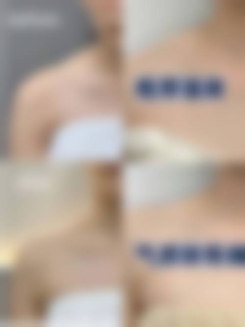 八、北京市美莱医疗美容医院真实的患者评价