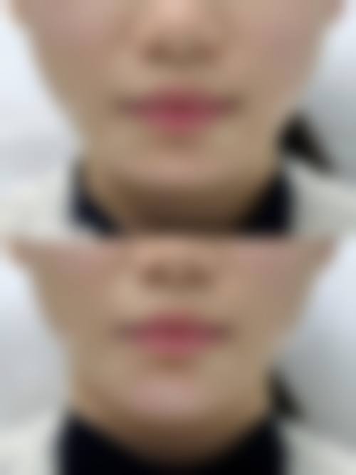 五、济南徐晶整形美容机构价格表