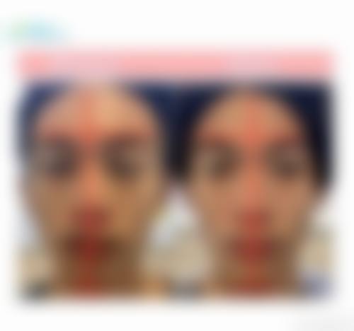 二、北京市美莱医疗美容医院怎么样？