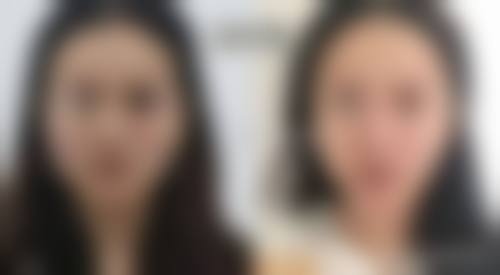 内蒙古自治区人民医院(整形美容科)价格表