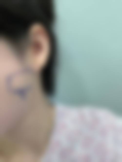 内蒙古自治区人民医院(整形美容科)地址及交通