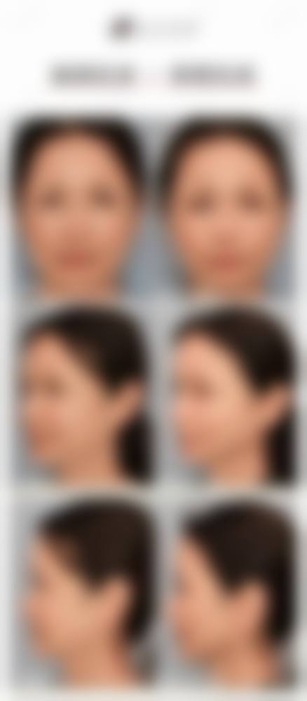 内蒙古自治区人民医院(整形美容科)预约方式