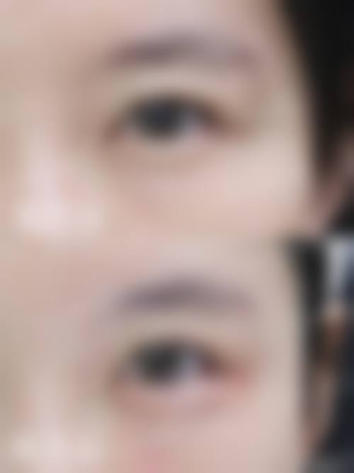 内蒙古自治区人民医院(整形美容科)真实的患者评价