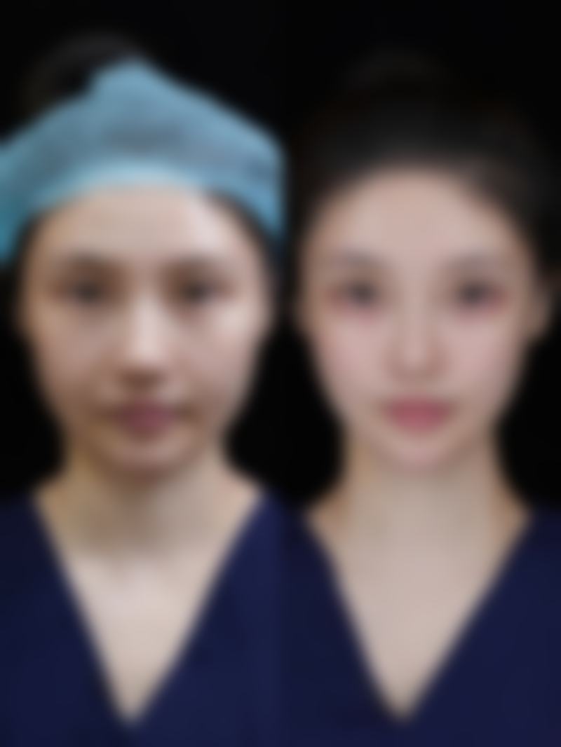 三、取材部位选择的影响因素