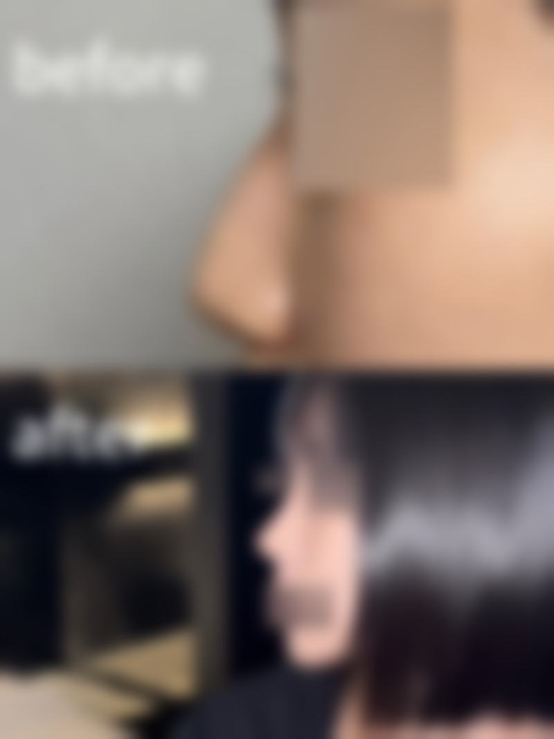 四、北京好年华整形医疗美容诊所特色项目