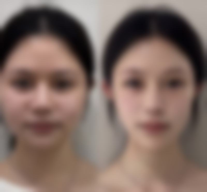 六、郑州安格润医疗美容门诊部价格表