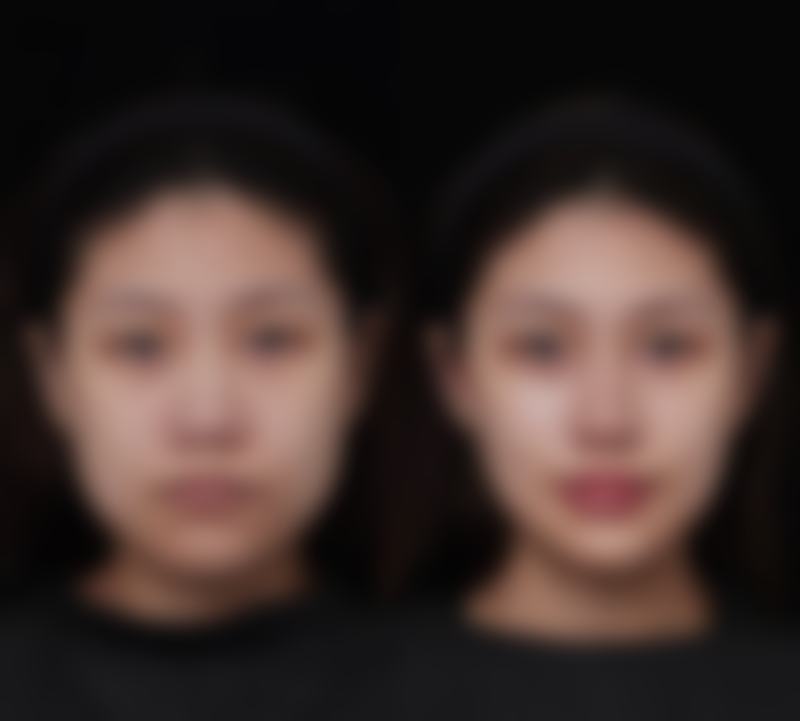 二、治疗方案选择