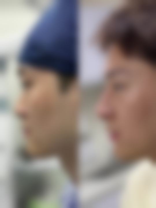 九、北京好年华整形医疗美容诊所真实的患者评价