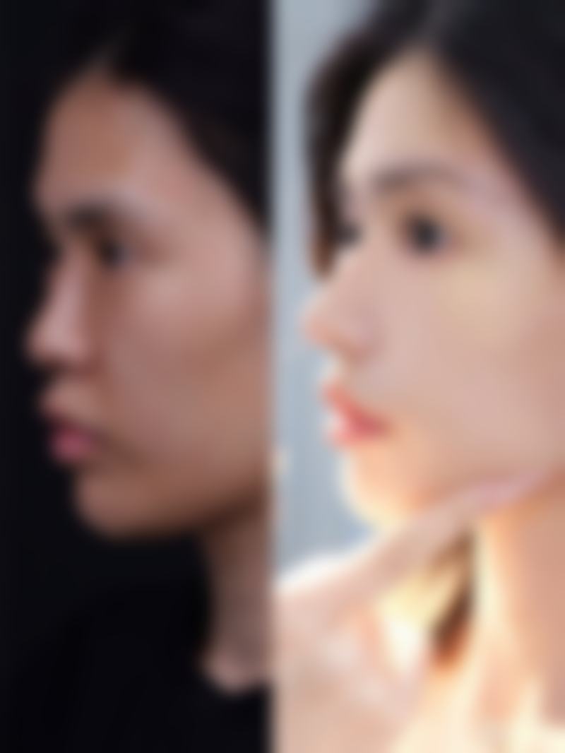 九、北京童仁医疗美容真实的患者评价