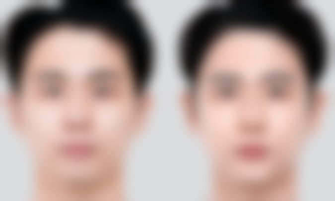 陈旧烫伤疤痕怎么去除？掌握评估、治疗方法及日常护理小妙招告别疤痕困扰