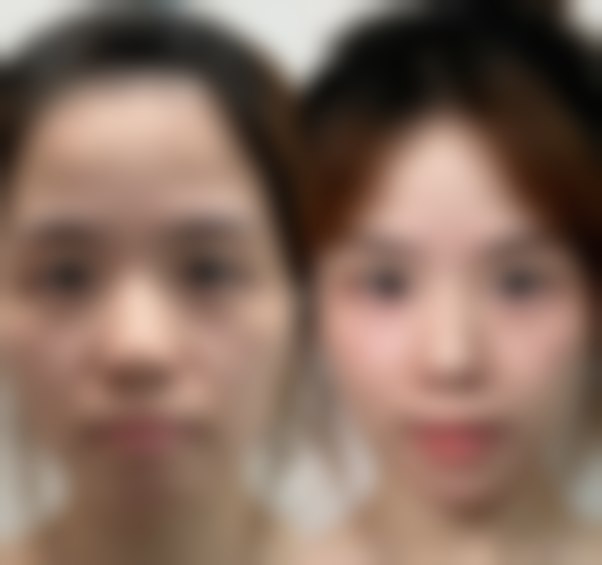 八、金水杨丽美颜医疗美容门诊部真实的患者评价