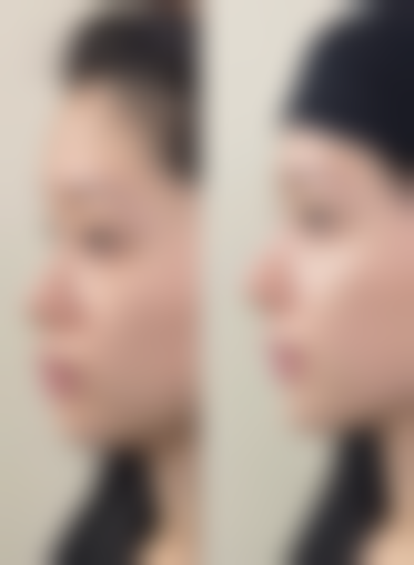 四、郑州安格润医疗美容门诊部特色项目