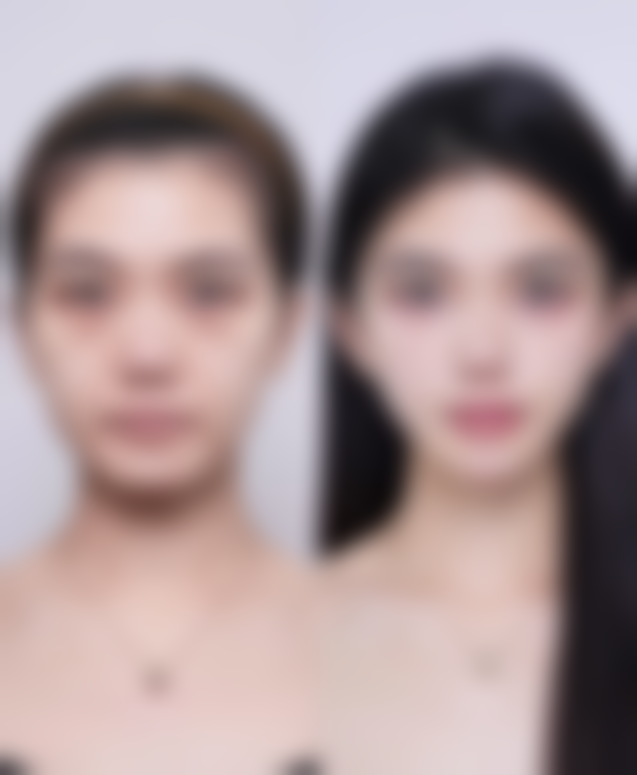 六、太原华美整形医院价格表